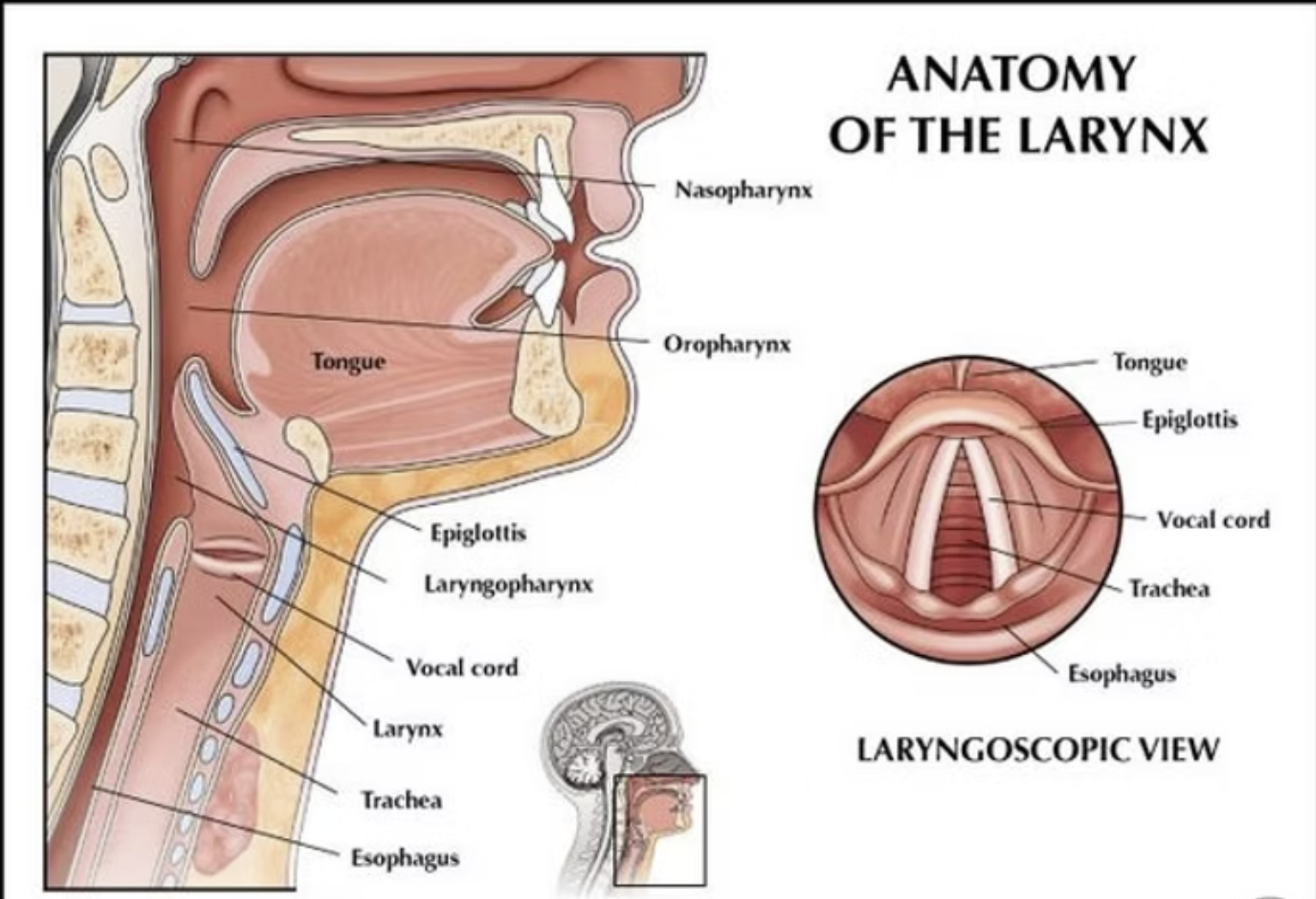LPR silent reflux — laryngopharyngeal reflux illustration